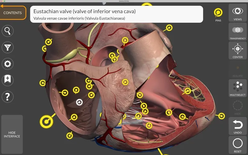 Anatomy 3D Atlas screenshot 2