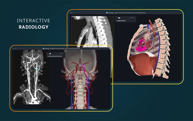 Complete Anatomy screenshot 7