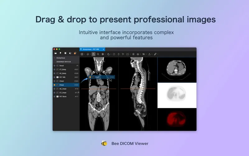 Bee DICOM Viewer screenshot 1