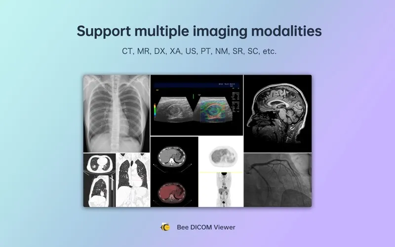 Bee DICOM Viewer screenshot 2