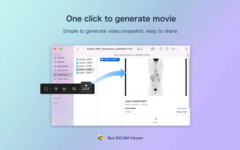 Bee DICOM Viewer screenshot 4