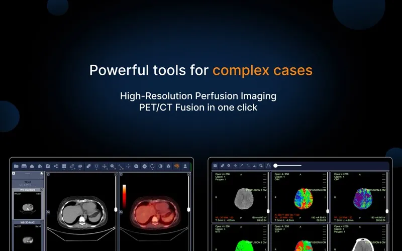 IMV Dicom Viewer screenshot 1