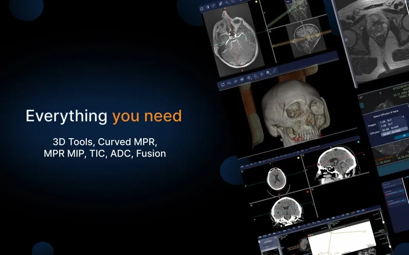 IMV Dicom Viewer screenshot 2