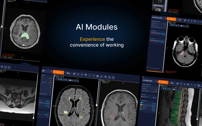 IMV Dicom Viewer screenshot 3