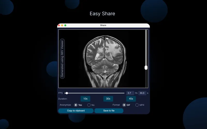IMV Dicom Viewer screenshot 4
