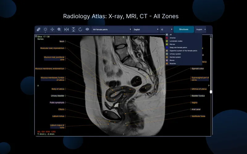 IMV Dicom Viewer screenshot 5