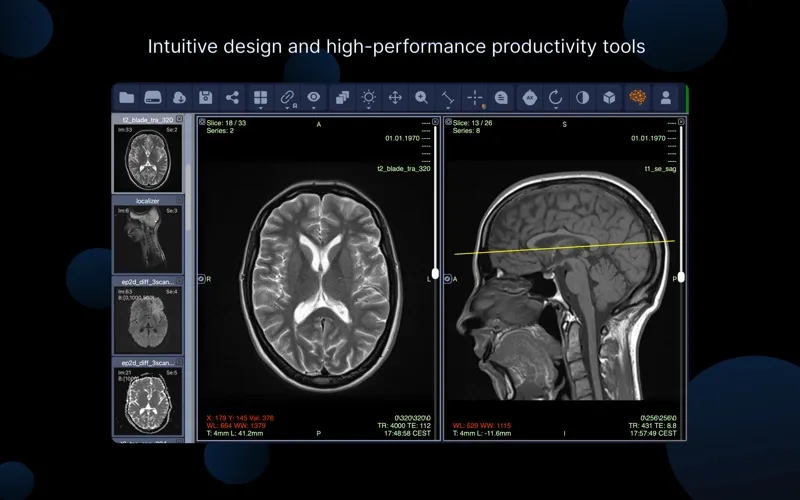 IMV Dicom Viewer screenshot 6