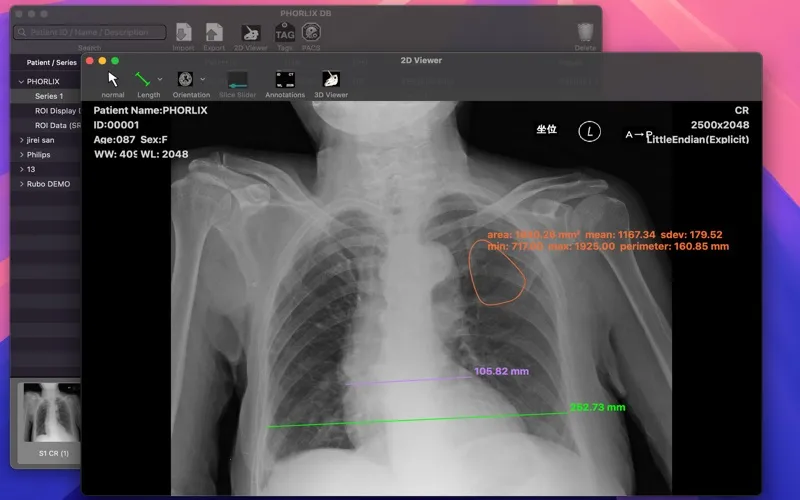 PHORLIX Lite screenshot 1