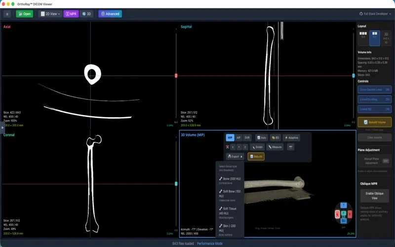 OrthoRay DICOM Engine screenshot 1