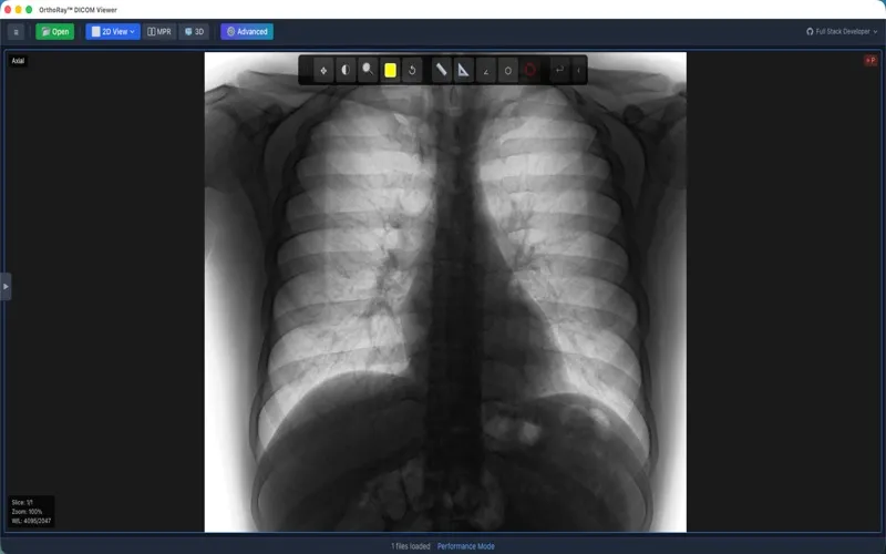 OrthoRay DICOM Engine screenshot 2