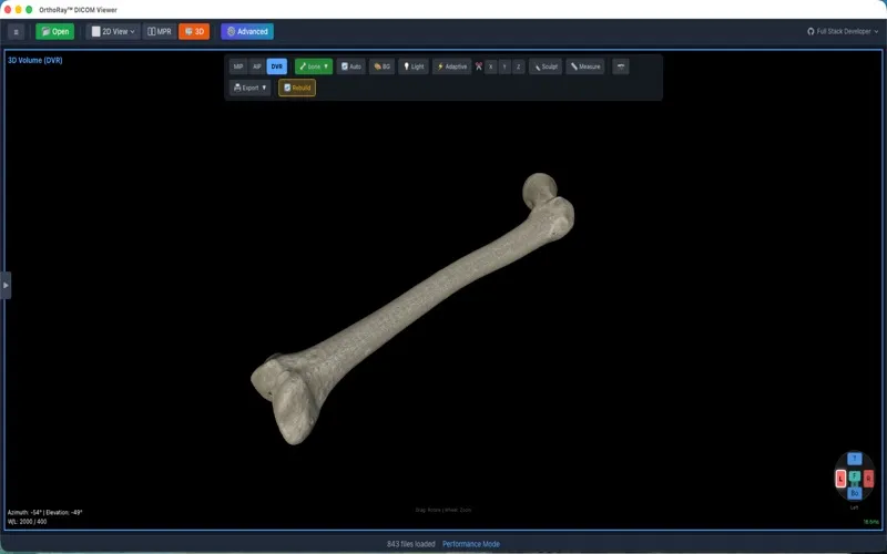 OrthoRay DICOM Engine screenshot 3