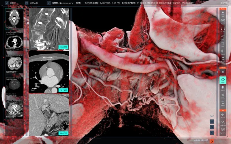 SurgicalAR screenshot 4