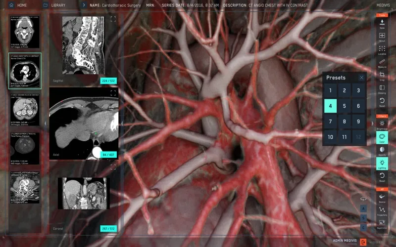 SurgicalAR screenshot 6