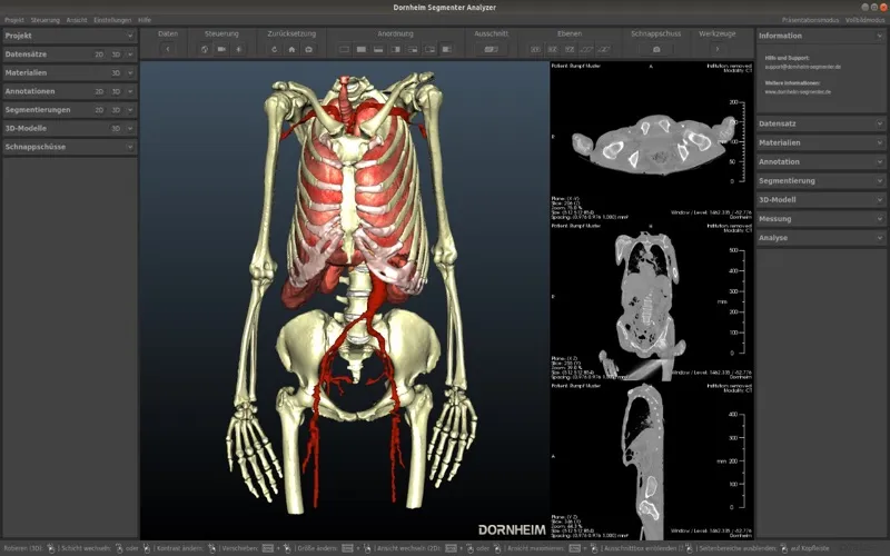 Dornheim DICOM Viewer screenshot 2