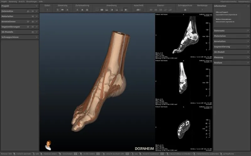 Dornheim DICOM Viewer screenshot 3