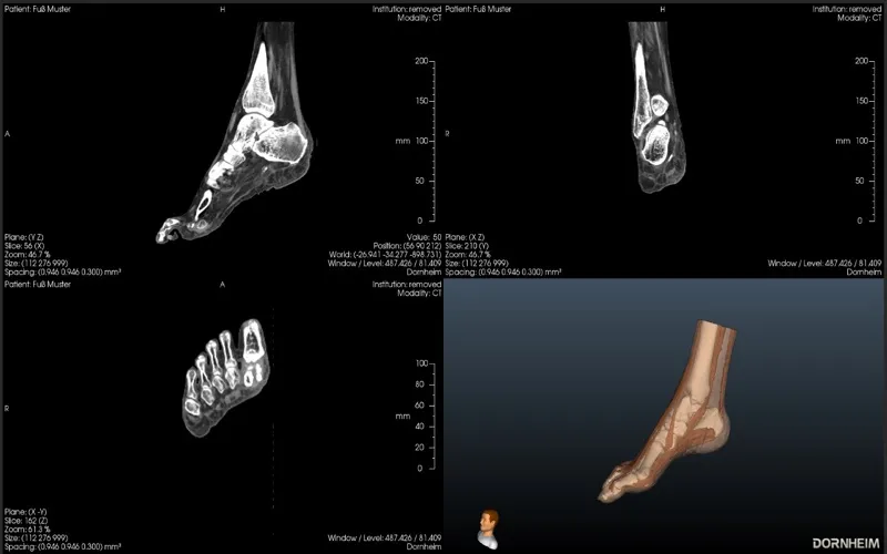 Dornheim DICOM Viewer screenshot 4